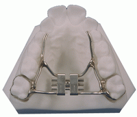 Palatal Expander